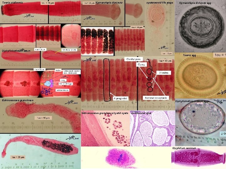 Taenia pisiformis Hymenolepis diminuta cysterceroid life stage Hymenolepis diminuta egg Diphyllobothrium latum Taenia egg