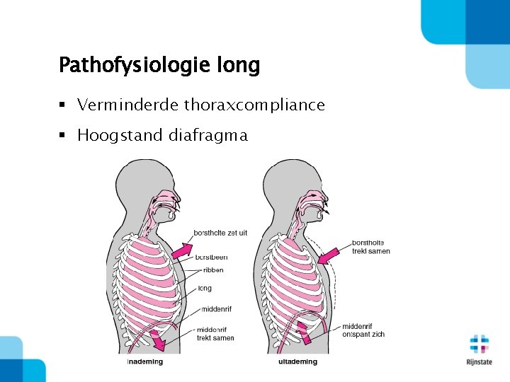 Pathofysiologie long § Verminderde thoraxcompliance § Hoogstand diafragma 