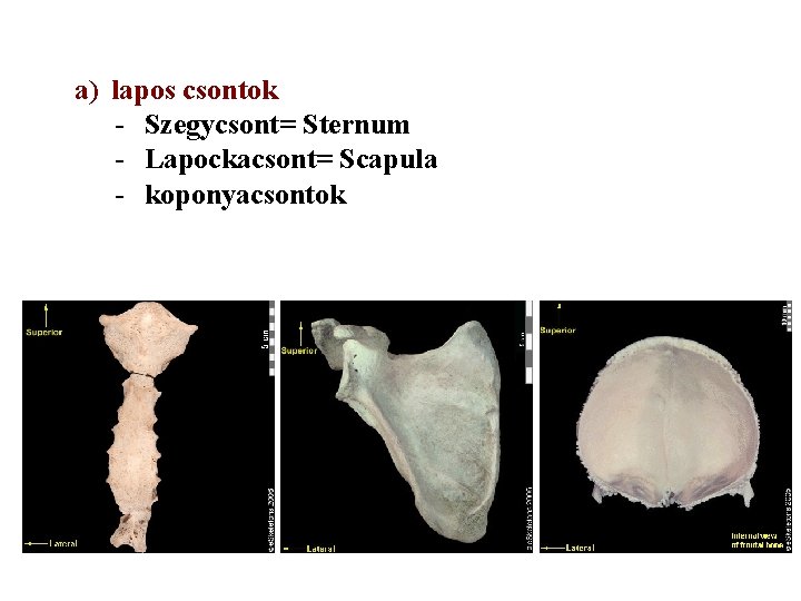 a) lapos csontok - Szegycsont= Sternum - Lapockacsont= Scapula - koponyacsontok 