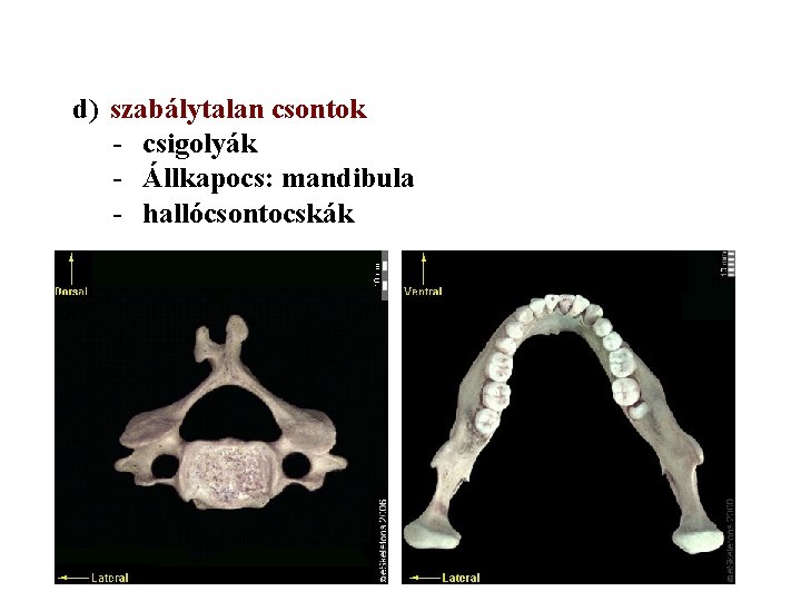 d) szabálytalan csontok - csigolyák - Állkapocs: mandibula - hallócsontocskák 