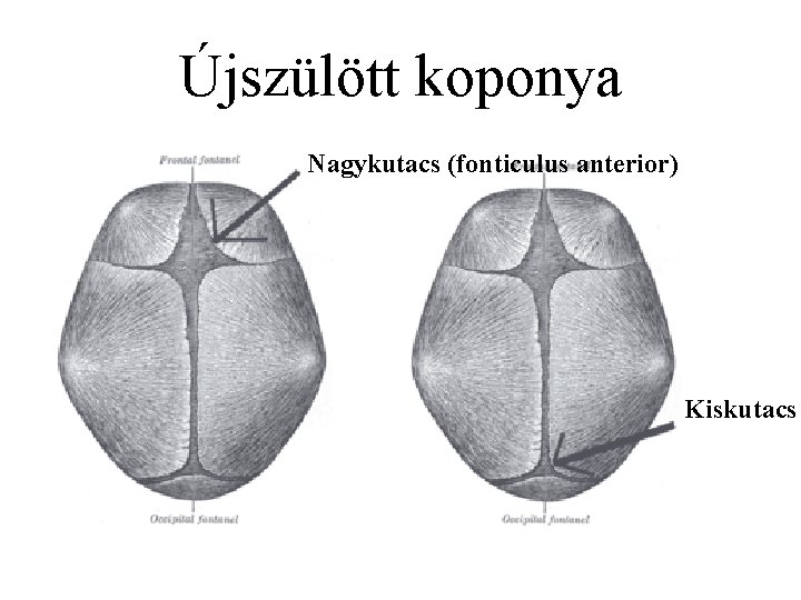 Újszülött koponya Nagykutacs (fonticulus anterior) Kiskutacs 