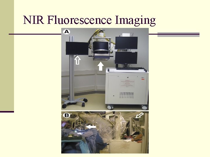 NIR Fluorescence Imaging 