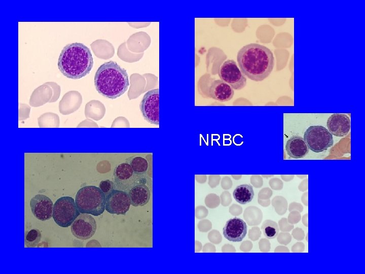 NRBC 