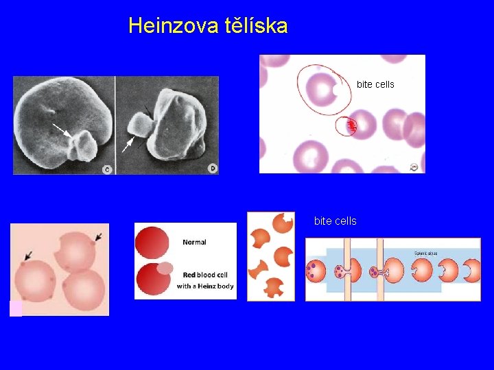 Heinzova tělíska bite cells 