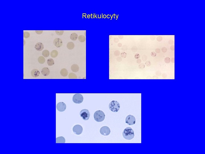Retikulocyty 
