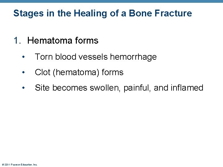 Stages in the Healing of a Bone Fracture 1. Hematoma forms • Torn blood