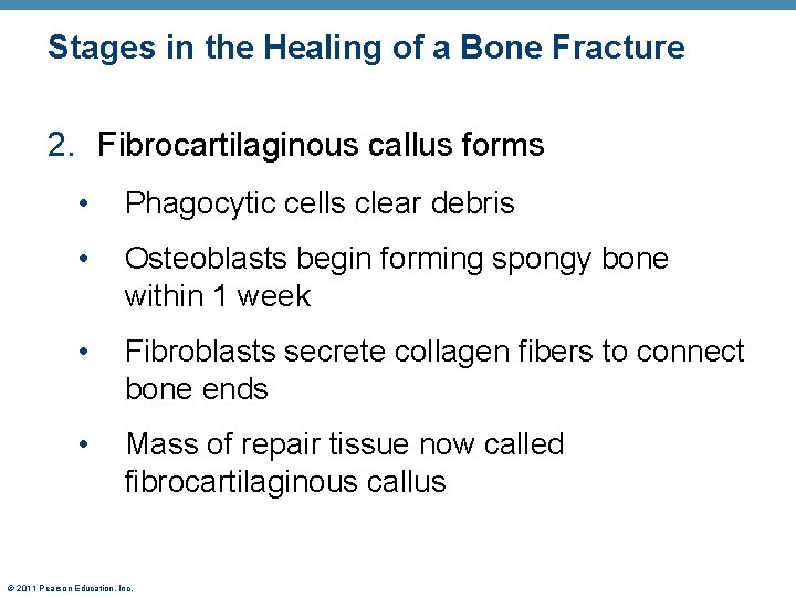 Stages in the Healing of a Bone Fracture 2. Fibrocartilaginous callus forms • Phagocytic