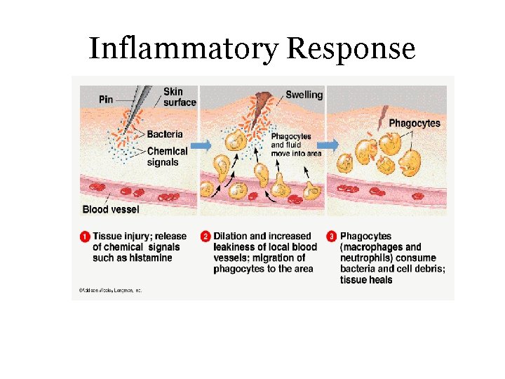 Inflammatory Response 