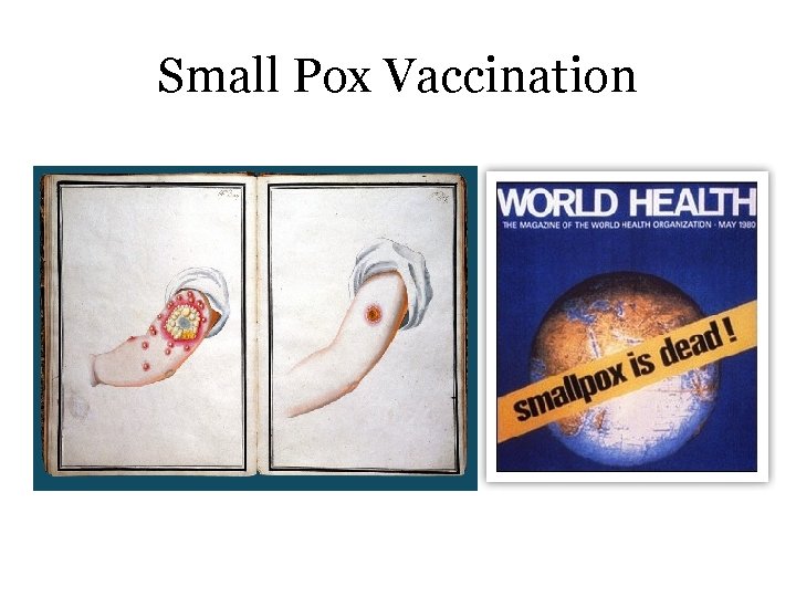 Small Pox Vaccination 