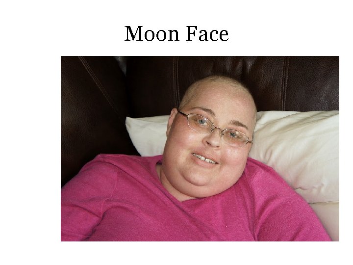 Moon Face 