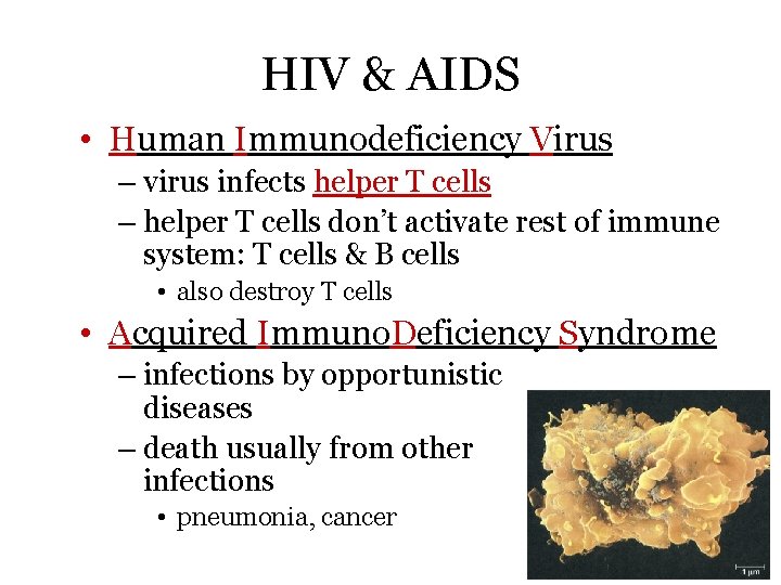 HIV & AIDS • Human Immunodeficiency Virus – virus infects helper T cells –