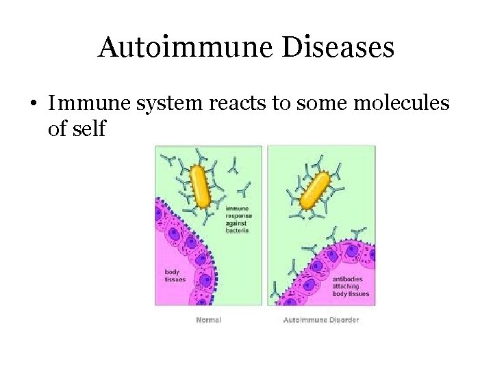 Autoimmune Diseases • Immune system reacts to some molecules of self 