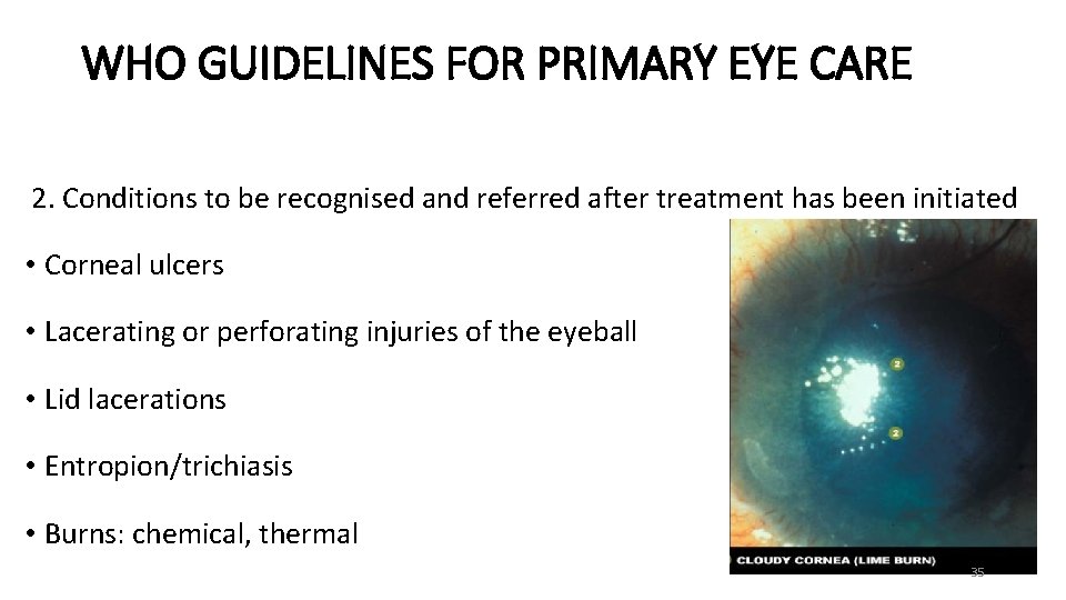 WHO GUIDELINES FOR PRIMARY EYE CARE 2. Conditions to be recognised and referred after