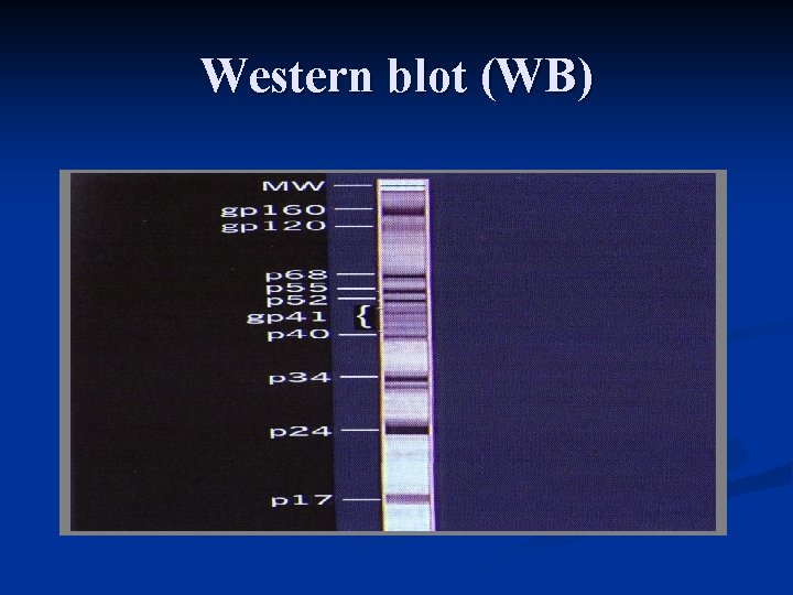 Western blot (WB) 