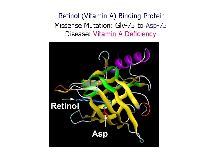 Retinol (Vitamin A) Binding Protein Missense Mutation: Gly-75 to Asp-75 Disease: Vitamin A Deficiency
