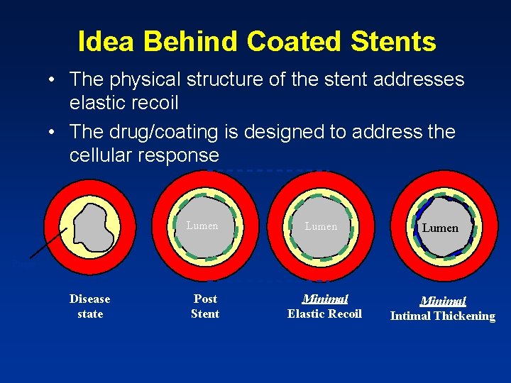 Idea Behind Coated Stents • The physical structure of the stent addresses elastic recoil