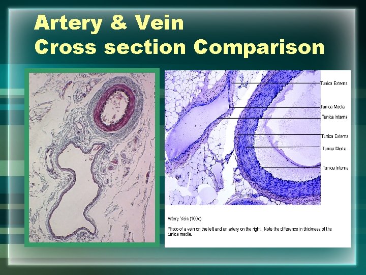 Artery & Vein Cross section Comparison 