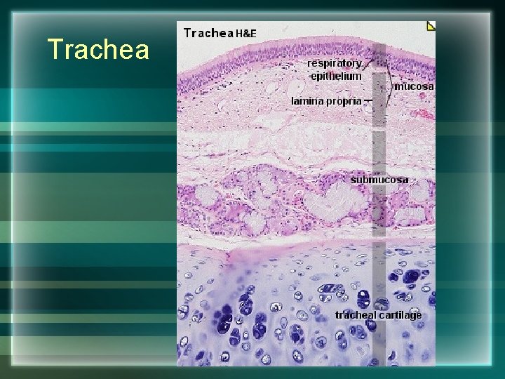Trachea 