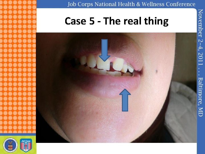 Case 5 - The real thing 
