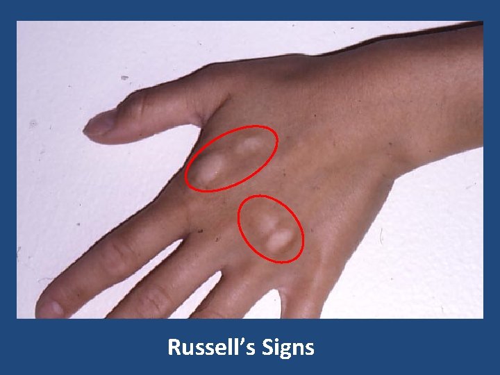 Russell’s Signs 