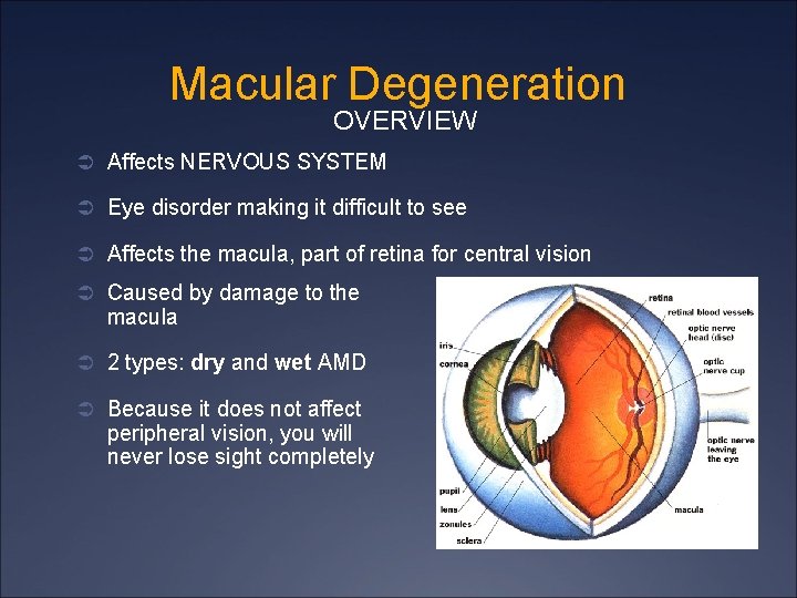 Macular Degeneration OVERVIEW Ü Affects NERVOUS SYSTEM Ü Eye disorder making it difficult to