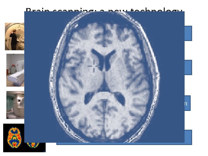 Brain scanning: a new technology MRI Scan: magnetic field CAT Scan: 180 degree x-rays
