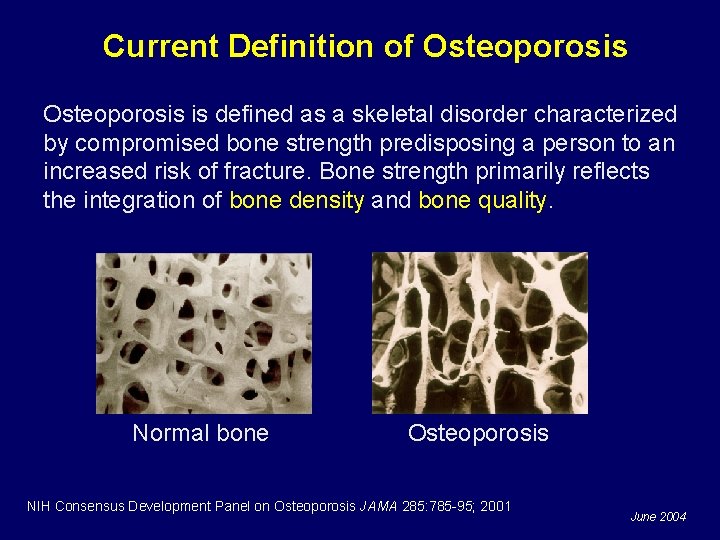 Current Definition of Osteoporosis is defined as a skeletal disorder characterized by compromised bone