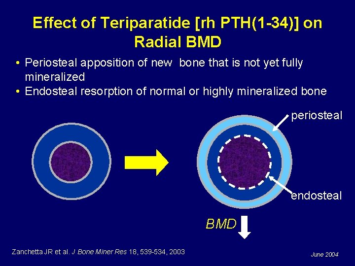 Effect of Teriparatide [rh PTH(1 -34)] on Radial BMD • Periosteal apposition of new