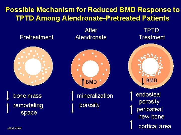 Possible Mechanism for Reduced BMD Response to TPTD Among Alendronate-Pretreated Patients Pretreatment bone mass