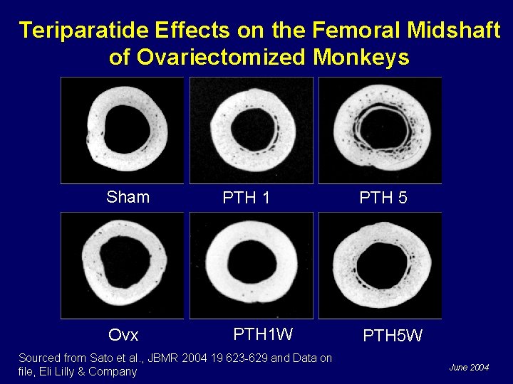 Teriparatide Effects on the Femoral Midshaft of Ovariectomized Monkeys Sham Ovx PTH 1 W