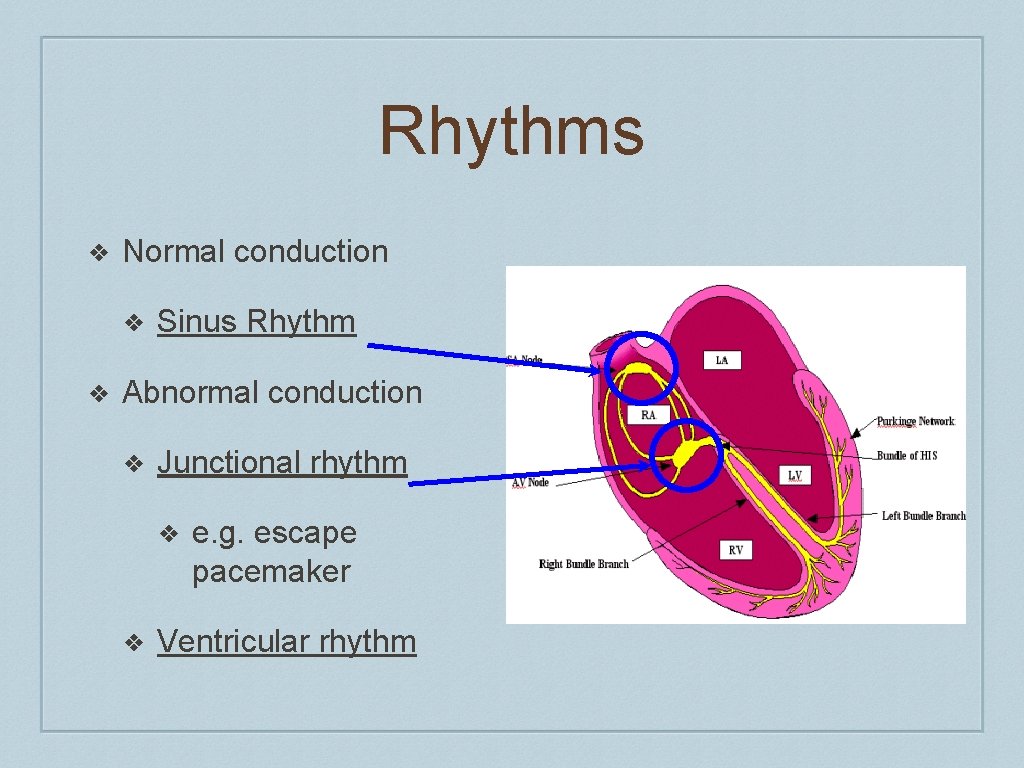 Rhythms ❖ Normal conduction ❖ ❖ Sinus Rhythm Abnormal conduction ❖ Junctional rhythm ❖