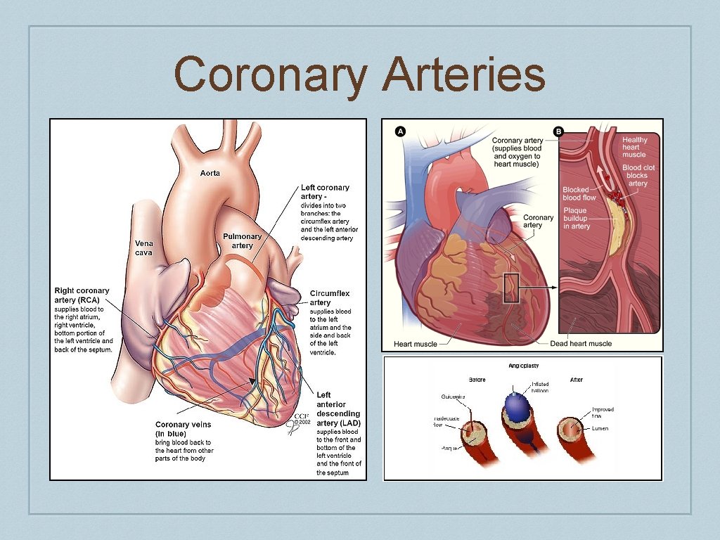 Coronary Arteries 