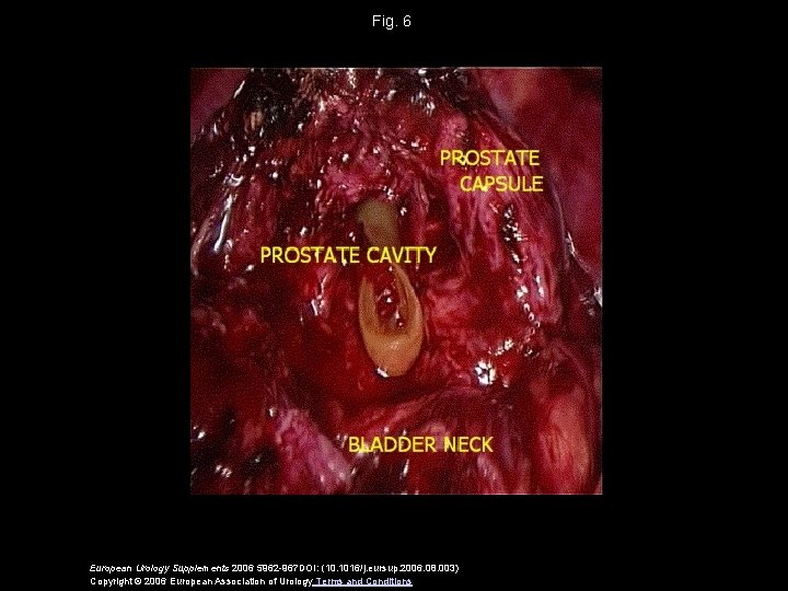 Fig. 6 European Urology Supplements 2006 5962 -967 DOI: (10. 1016/j. eursup. 2006. 08.