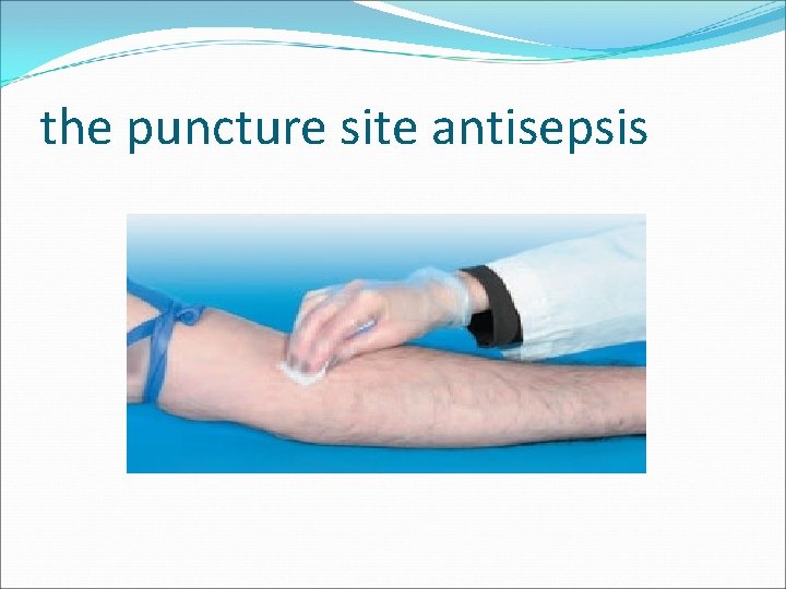 the puncture site antisepsis 