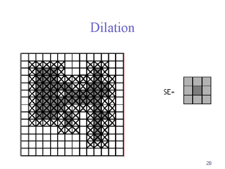 Dilation 28 