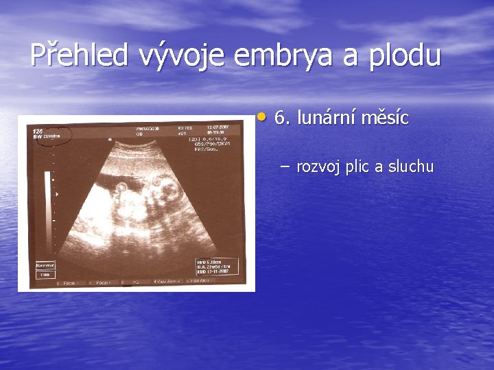 Přehled vývoje embrya a plodu • 6. lunární měsíc – rozvoj plic a sluchu