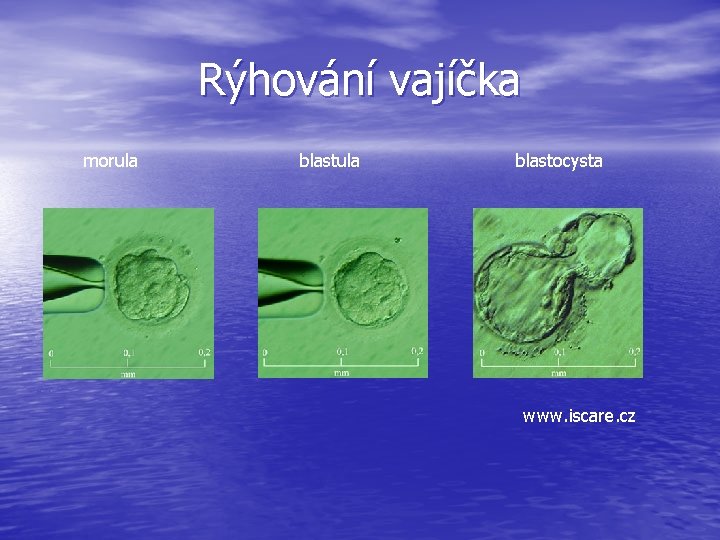 Rýhování vajíčka morula blastocysta www. iscare. cz 