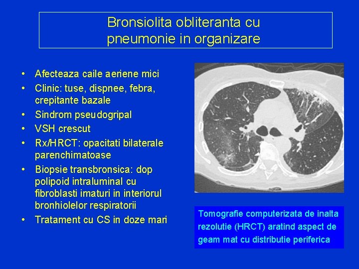 Bronsiolita obliteranta cu pneumonie in organizare • Afecteaza caile aeriene mici • Clinic: tuse,