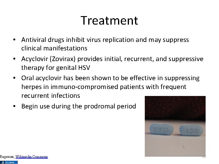Treatment • Antiviral drugs inhibit virus replication and may suppress clinical manifestations • Acyclovir
