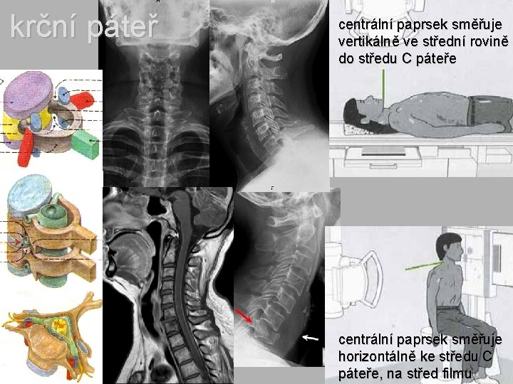 krční páteř centrální paprsek směřuje vertikálně ve střední rovině do středu C páteře centrální