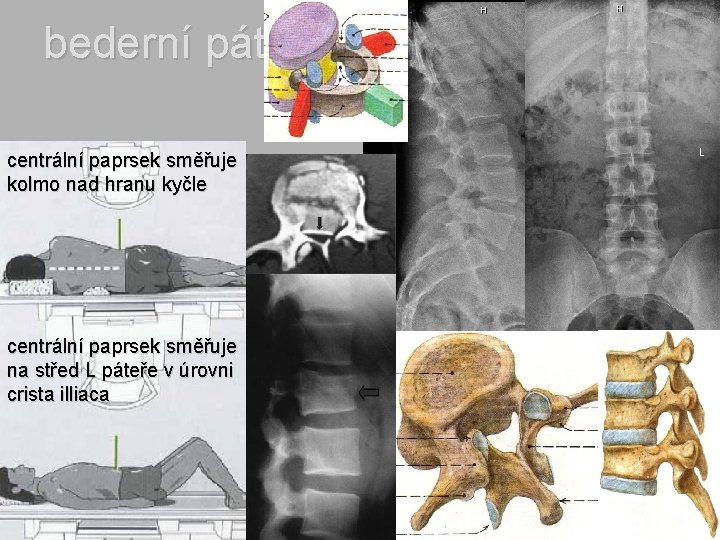 bederní páteř centrální paprsek směřuje kolmo nad hranu kyčle centrální paprsek směřuje na střed