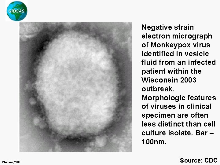 GIDSAS Negative strain electron micrograph of Monkeypox virus identified in vesicle fluid from an