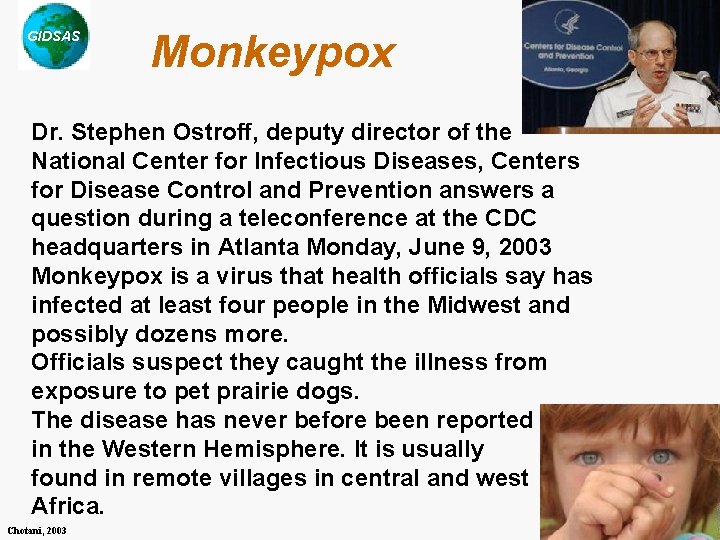 GIDSAS Monkeypox Dr. Stephen Ostroff, deputy director of the National Center for Infectious Diseases,