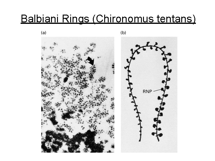 Balbiani Rings (Chironomus tentans) 