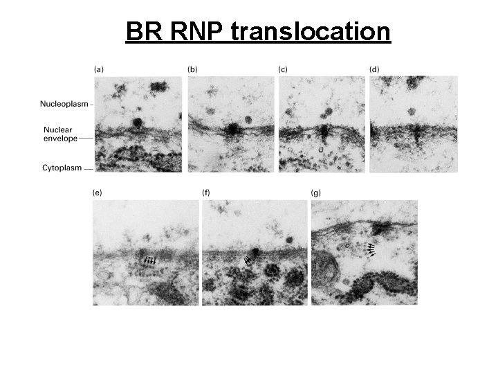 BR RNP translocation 