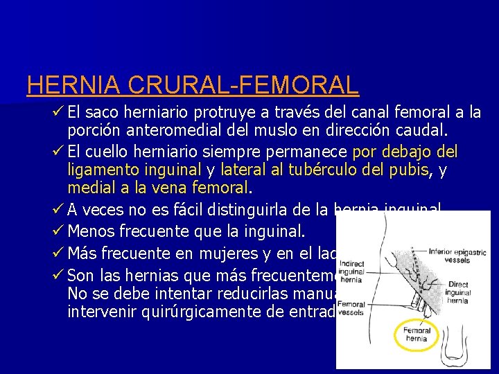 HERNIA CRURAL-FEMORAL ü El saco herniario protruye a través del canal femoral a la