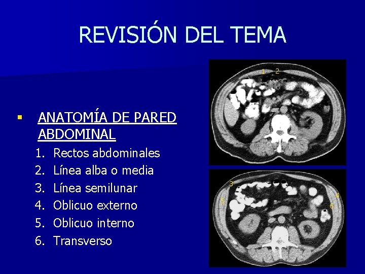 REVISIÓN DEL TEMA 1 § 2 ANATOMÍA DE PARED ABDOMINAL 1. 2. 3. 4.