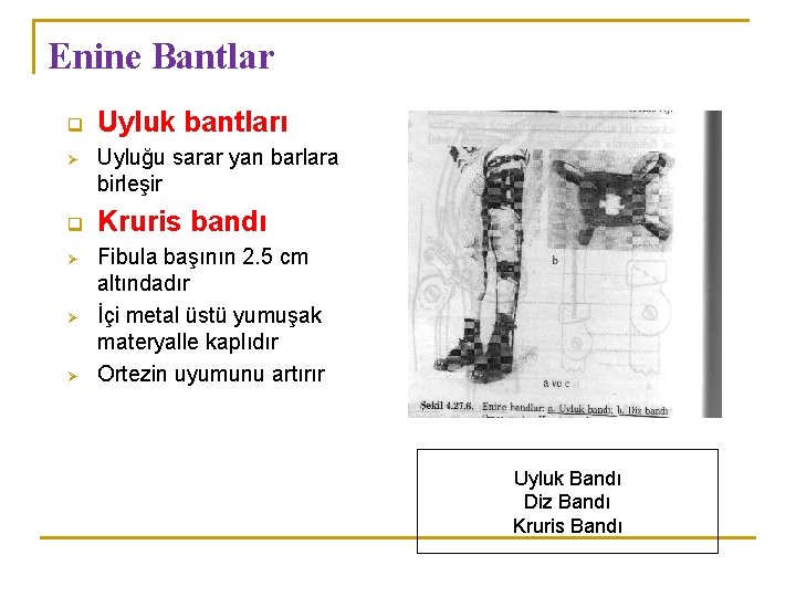 Enine Bantlar q Ø Ø Ø Uyluk bantları Uyluğu sarar yan barlara birleşir Kruris