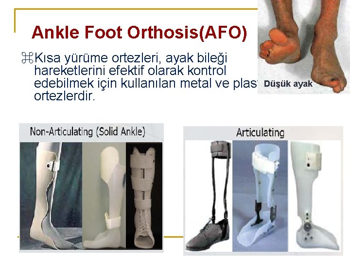 Ankle Foot Orthosis(AFO) ⌘Kısa yürüme ortezleri, ayak bileği hareketlerini efektif olarak kontrol edebilmek için
