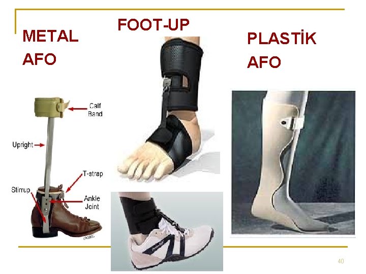 METAL AFO FOOT-UP PLASTİK AFO 40 